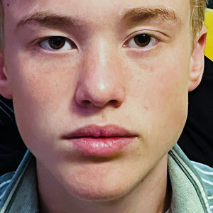 Meet your Posher, Fletcher